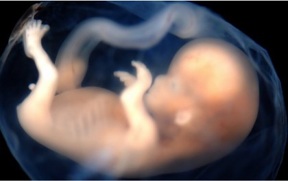 VIDEO/ Cazul care a ŞOCAT lumea medicală: O fetiţă s-a născut „ÎNSĂRCINATĂ” cu GEMENI