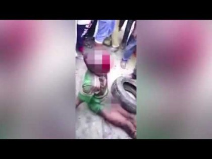 Imagini cu impact EMOȚIONAL! Un băiat a fost BĂTUT apoi ARS pe STRADĂ (VIDEO)