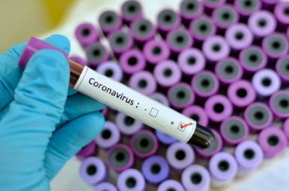 39 de noi cazuri de coronavirus și un deces, în ultimele 24 de ore la Arad