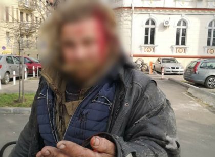 Un bărbat a fost BĂTUT cu un ciomag, în centrul Aradului. L-a salvat simțul civic al unui arădean