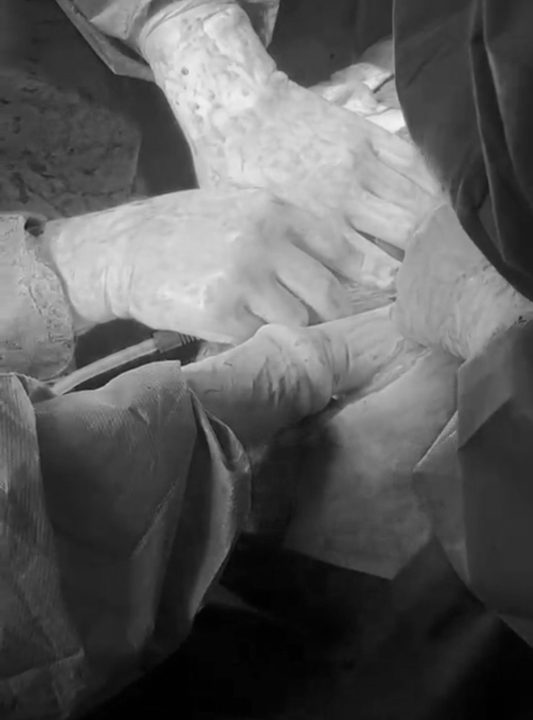 Bărbat salvat de medicii arădeni, după o intervenție chirurgicală contracronometru item-thumbnail