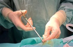 Intervenție salvatoare pentru o tânără mamă. Medicii arădeni i-au extirpat o tumoră cerebrală agresivă de mari dimensiuni item-thumbnail