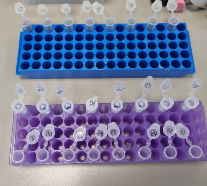 Institutul Cantacuzino a confirmat cazul de hantavirus din județul Arad item-thumbnail